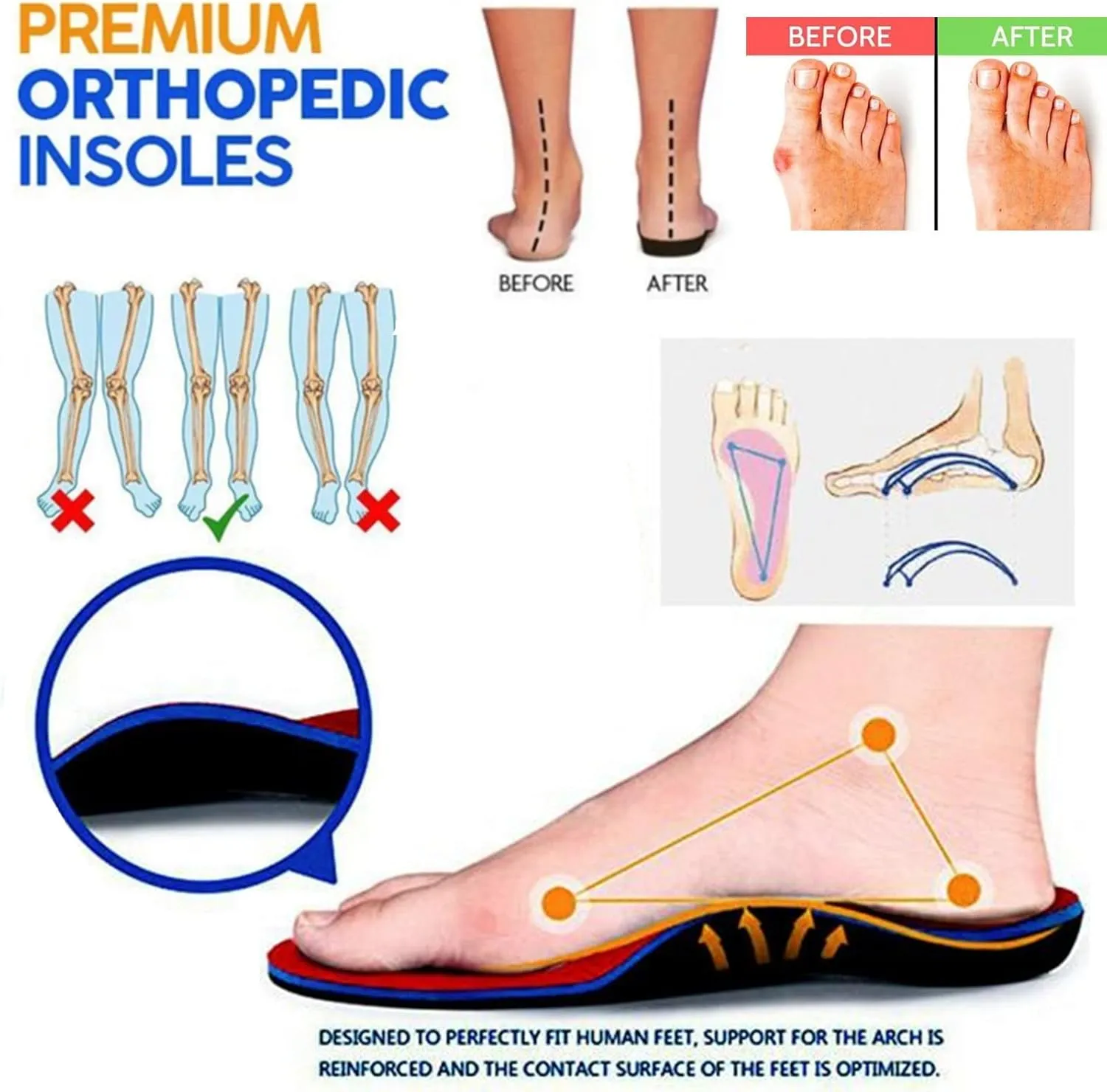 oiangi Orthopedic Sandals for Women with Arch Support Dressy Summer Comfortable Wedge Fish Mouth Peep Toe Slip on Platform Slipper Flower Hollow Beach Shoes